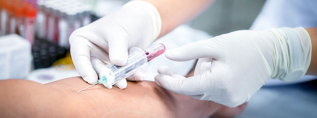 Taking blood sample from a patient in the hospital.